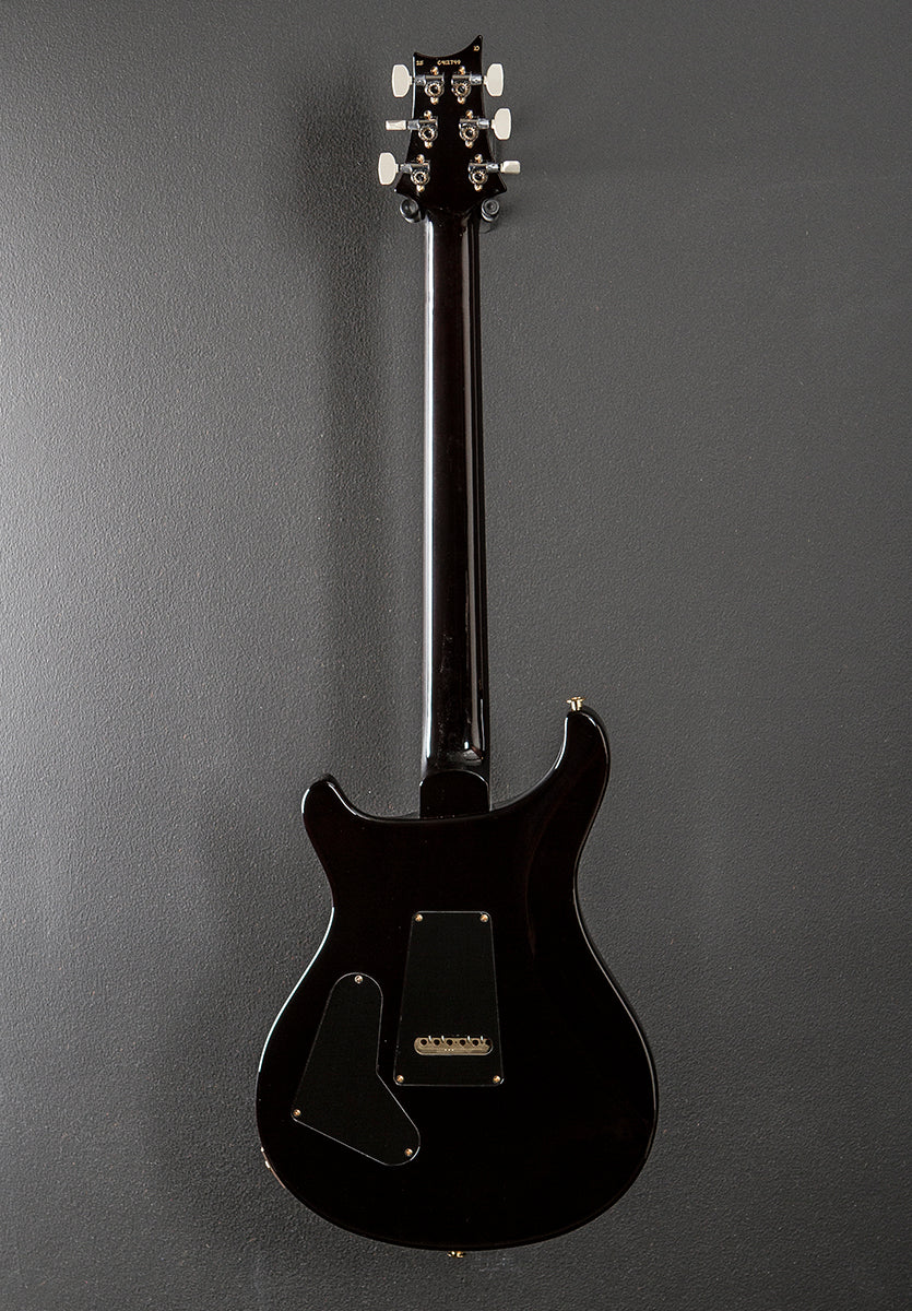 Custom 24 10 Top - Black Gold Wraparound Burst - Image 5